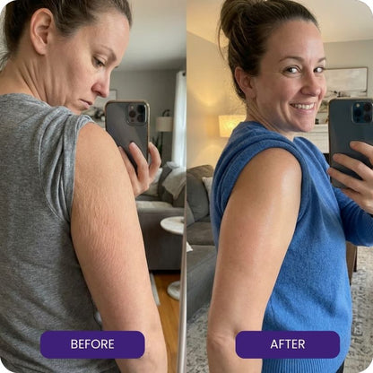 Vitaecharm Body Oil for GLP-1 Users (+ Face Oil)